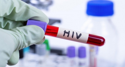 මාස 9ක් තුළ HIV ආසාදිතයින් 3000ක්